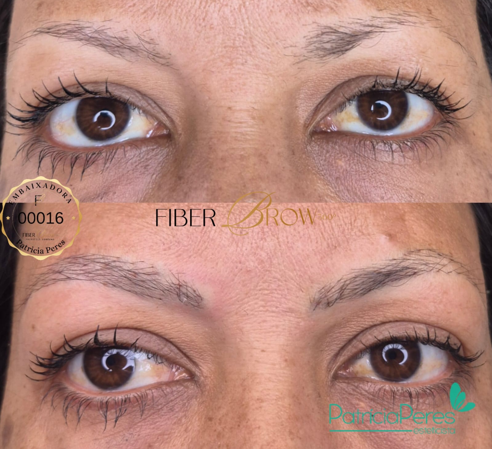 Antes e depois, primeira sessão, caso de alopecia, cliente Neide