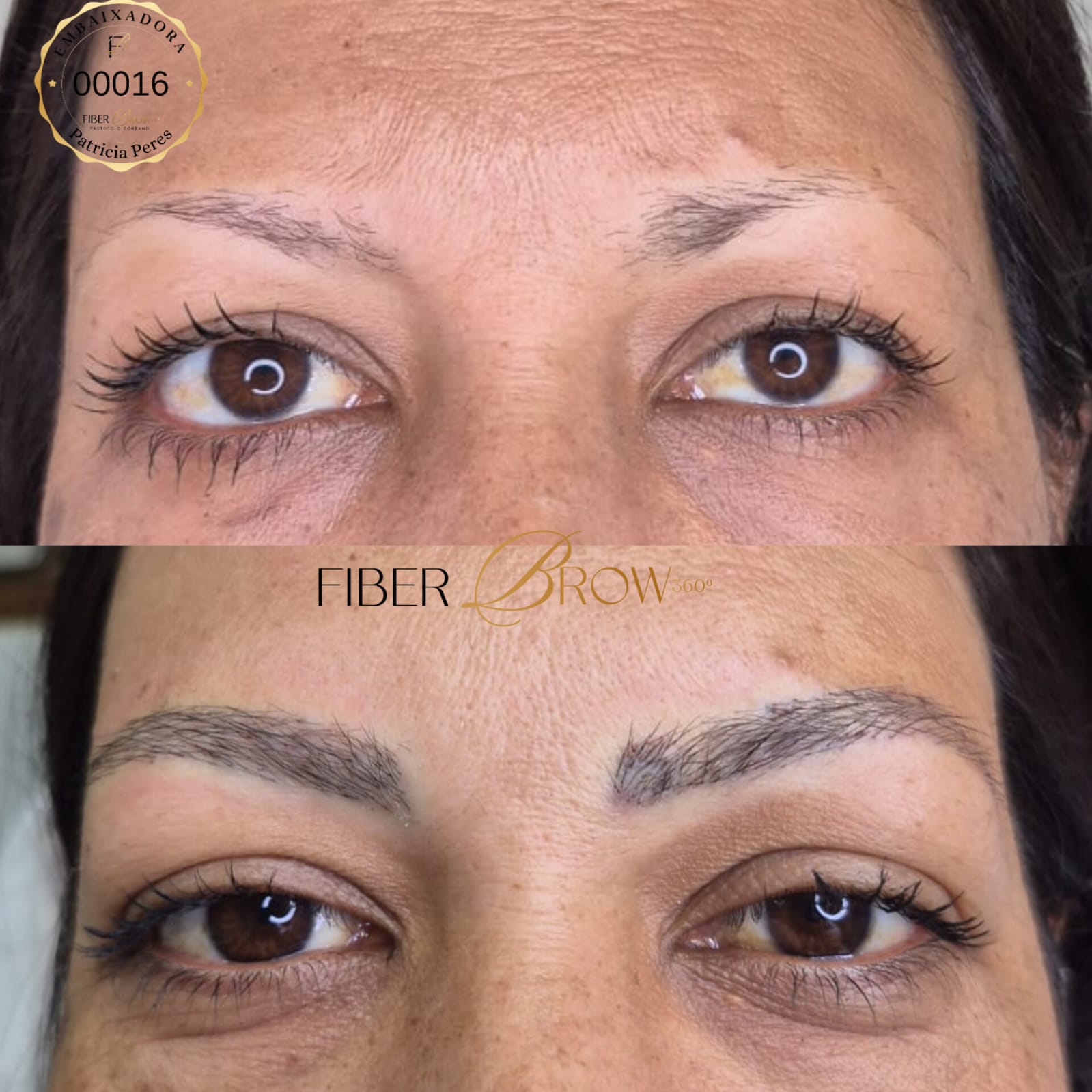 Antes e depois, segunda sessão, caso de alopecia, cliente Neide