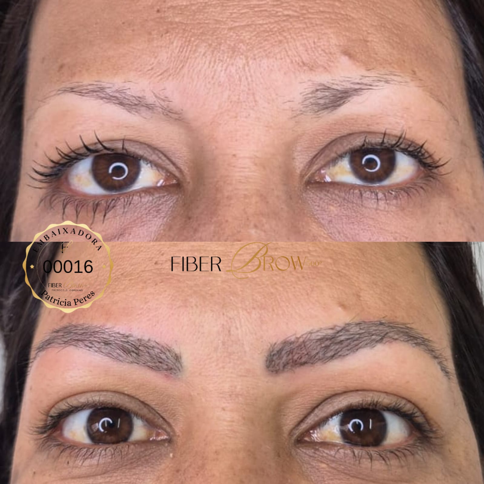 Antes e depois, terceira sessão, caso de alopecia, cliente Neide