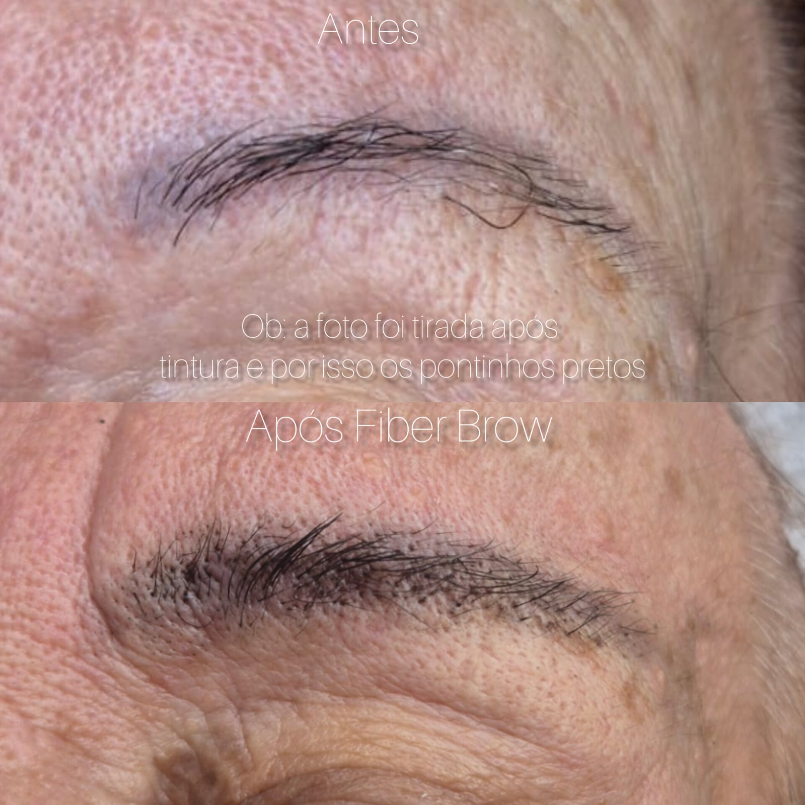 Antes e após Fiber Brow, pele madura, segunda sobrancelha da mesma cliente