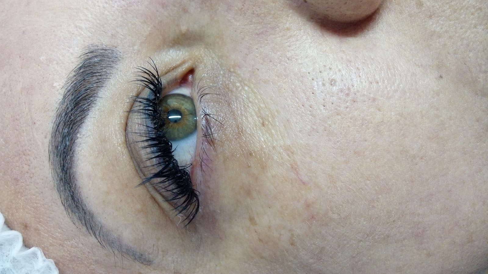 Antes e depois com moldura, sobrancelha rala preenchida com densidade