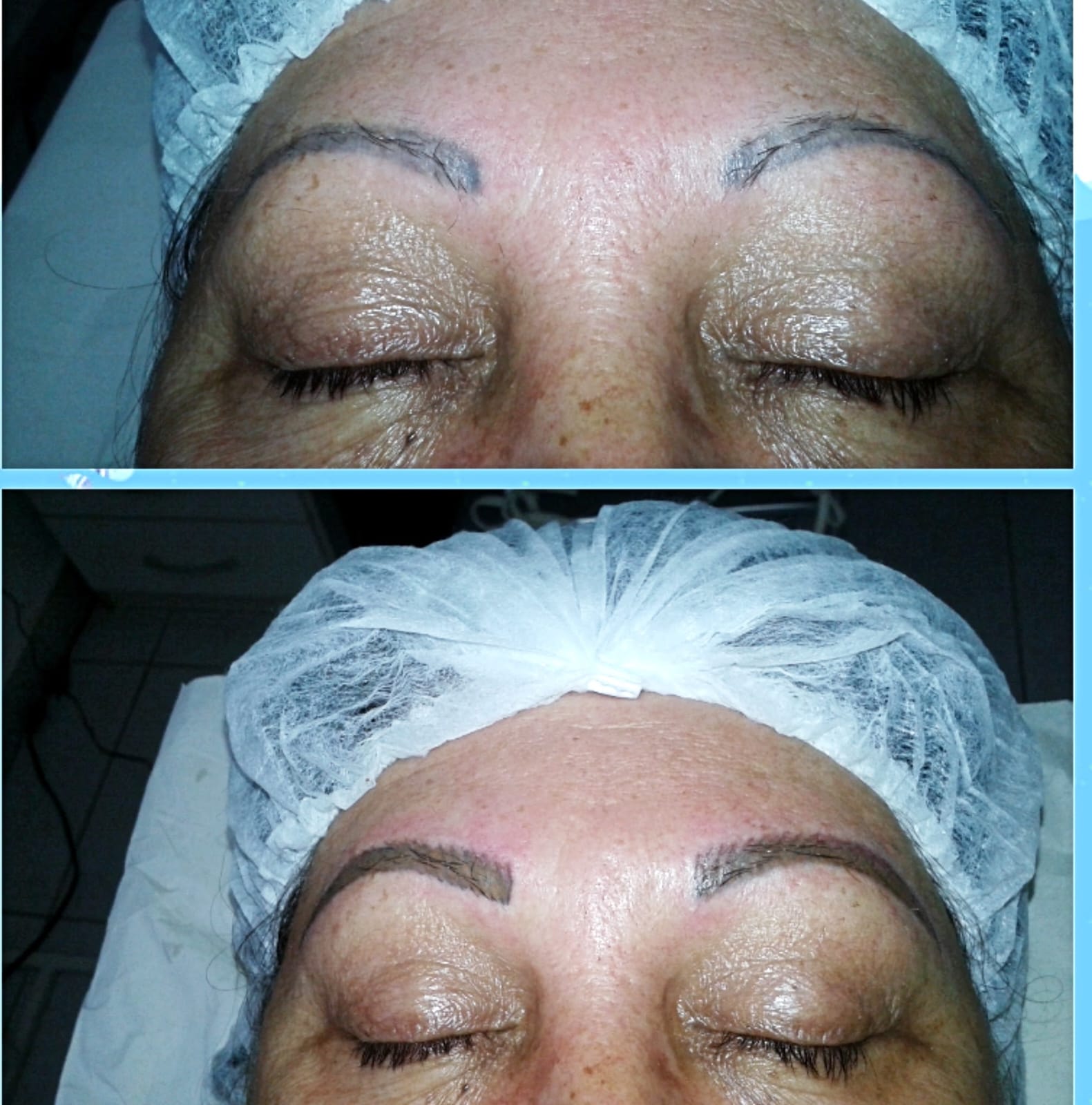 Antes e depois com moldura, sobrancelha falhada preenchida fio a fio