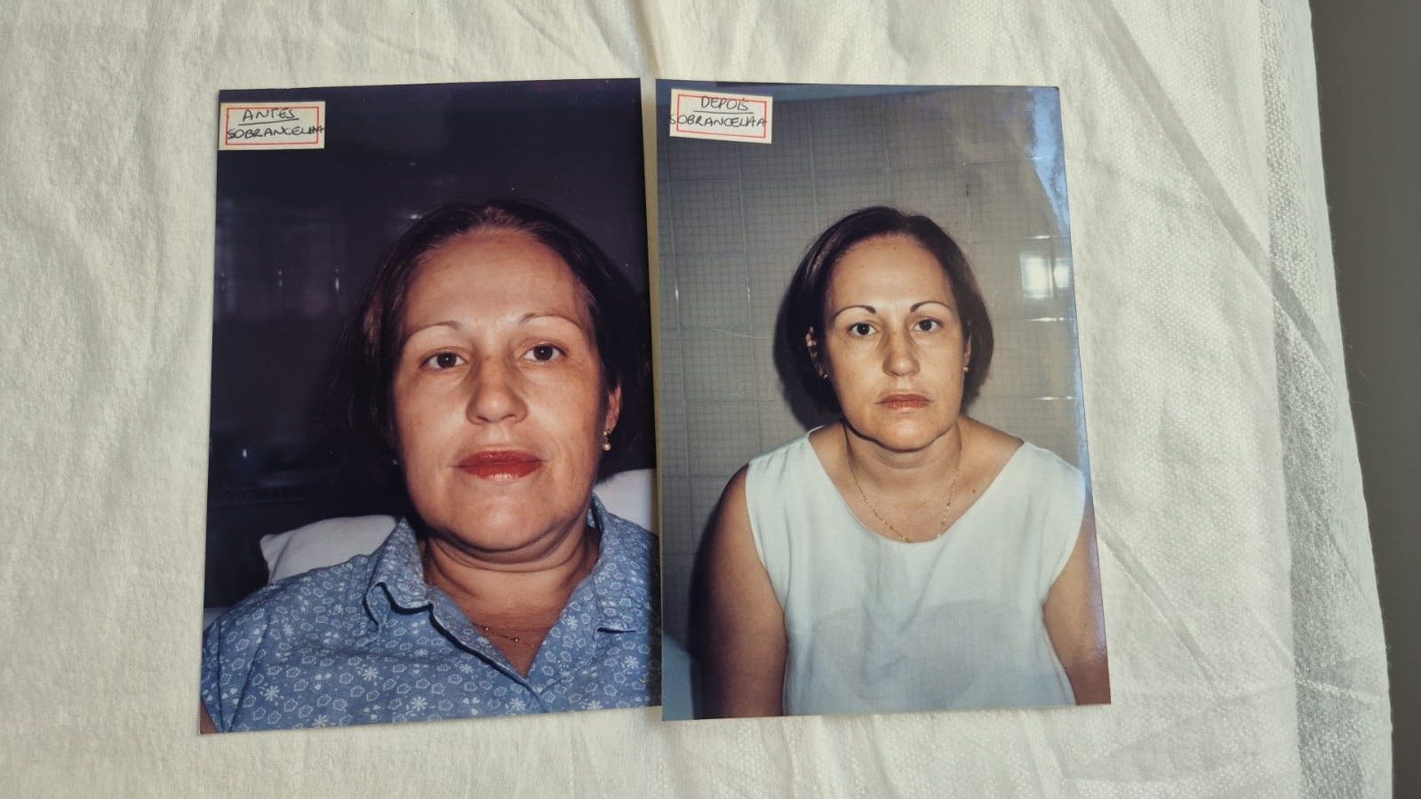 Antes e depois de maquiagem definitiva, cliente de blusa azul